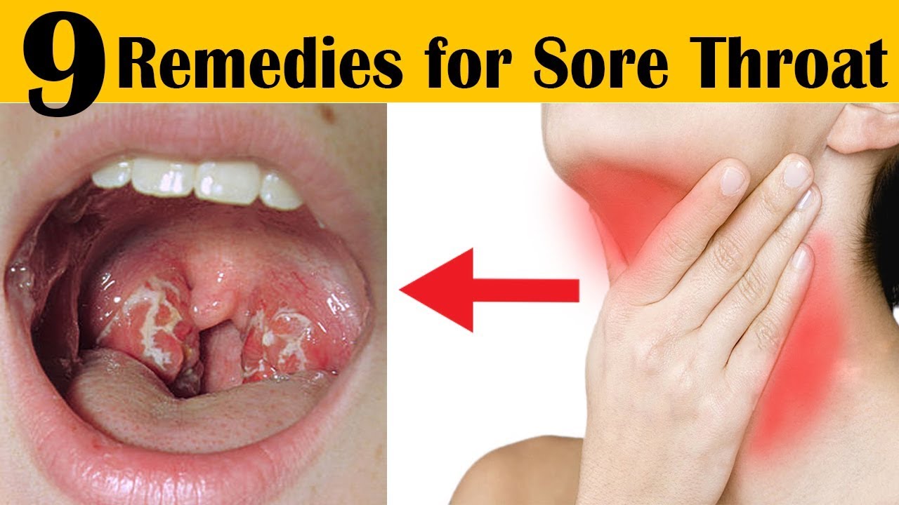 How To Get Rid Of A Sore Throat Fast Overnight 9 Home Remedies For Sore Throat And Cough Youtube