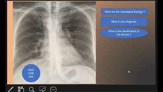 OSCE CASE 001 : Right sided aortic arch screenshot 5