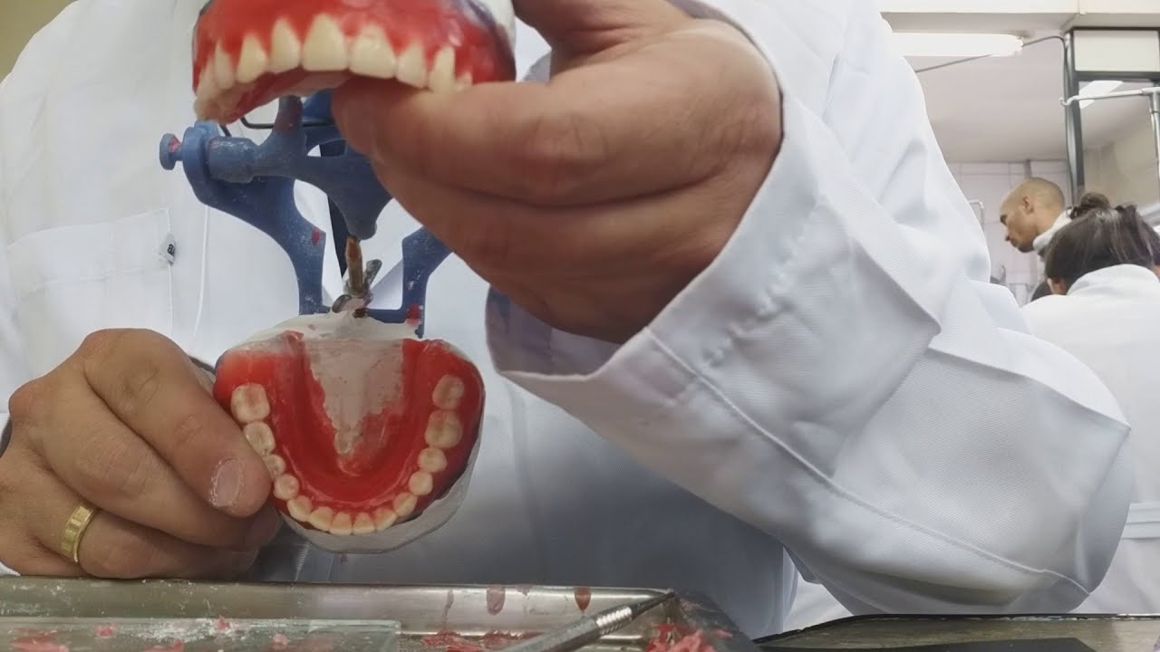 Curso técnico em prótese dentária - YouTube