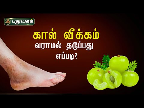கால் வீக்கம் எதனால் ஏற்படுகிறது? வராமல் தடுப்பது எப்படி? Swelling | Dr.M.S.UshaNandhini