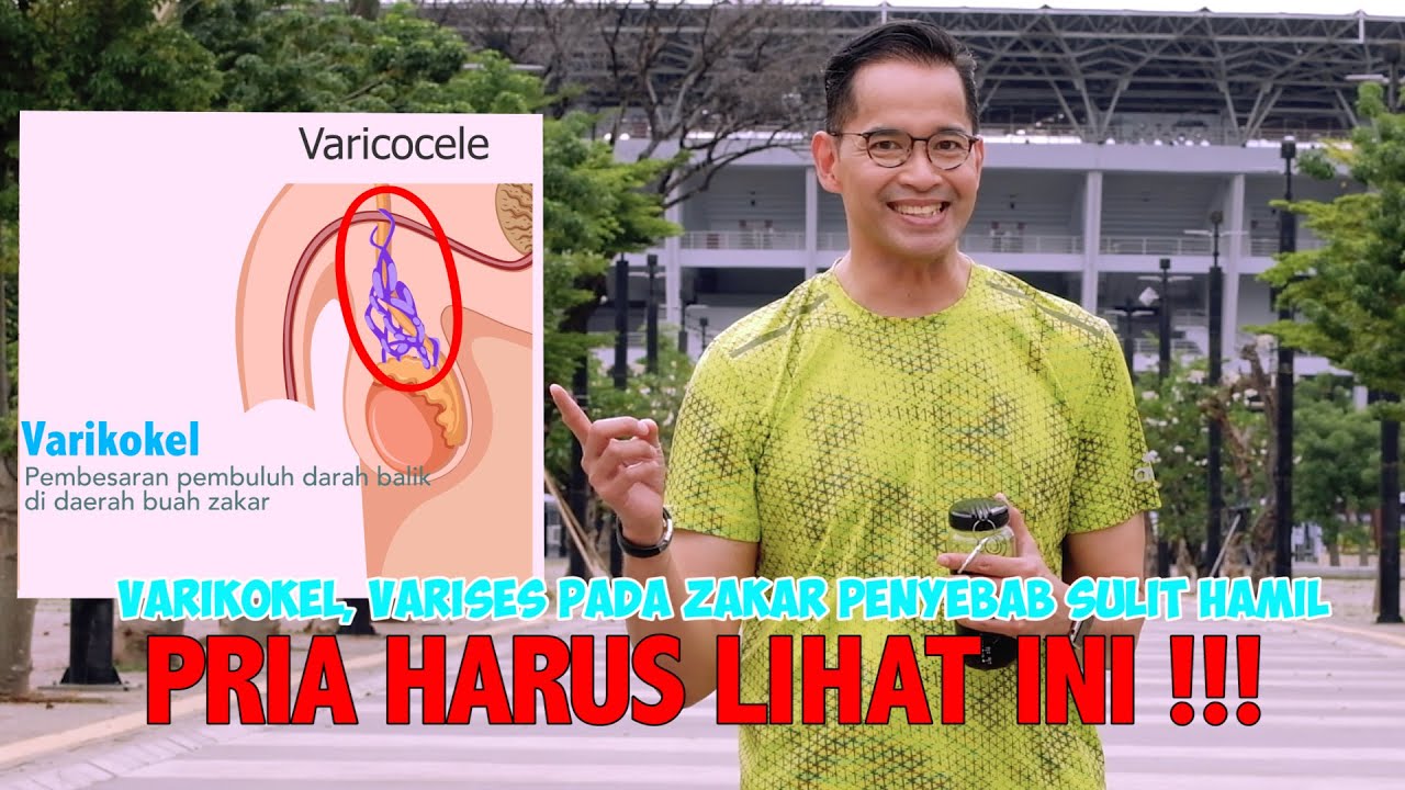 VARIKOKEL pada laki-laki…….BERBAHAYA(dr Boy Abidin)