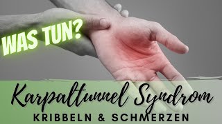 Karpaltunnelsyndrom: Übungen & Tipps bei Schmerzen, Kribbeln & Taubheit.