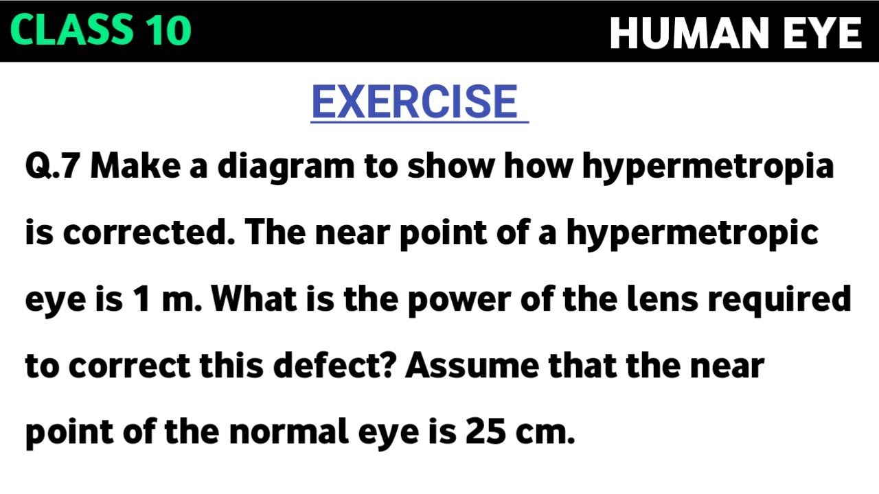 Make A Diagram To Show How Hypermetropia Is Corrected The Near Point Make A Diagram To Show How Hypermetropia Is Corrected The Near Point
