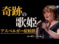 アスペルガー症候群を告白/スーザン・ボイル