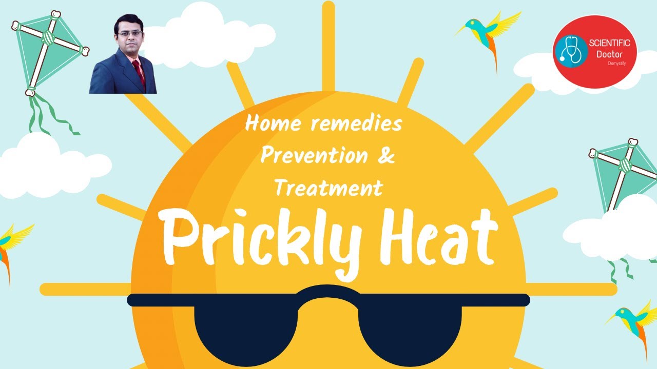 Prickly Heat Miliaria Heat Rash Prevention, Treatment & Home
