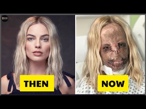 15 Celebrity Plastic Surgery Disasters That Ruined Their Looks | Then and Now 2026 15 Celebrity Plastic Surgery Disasters That Ruined Their Looks | Then and Now 2026