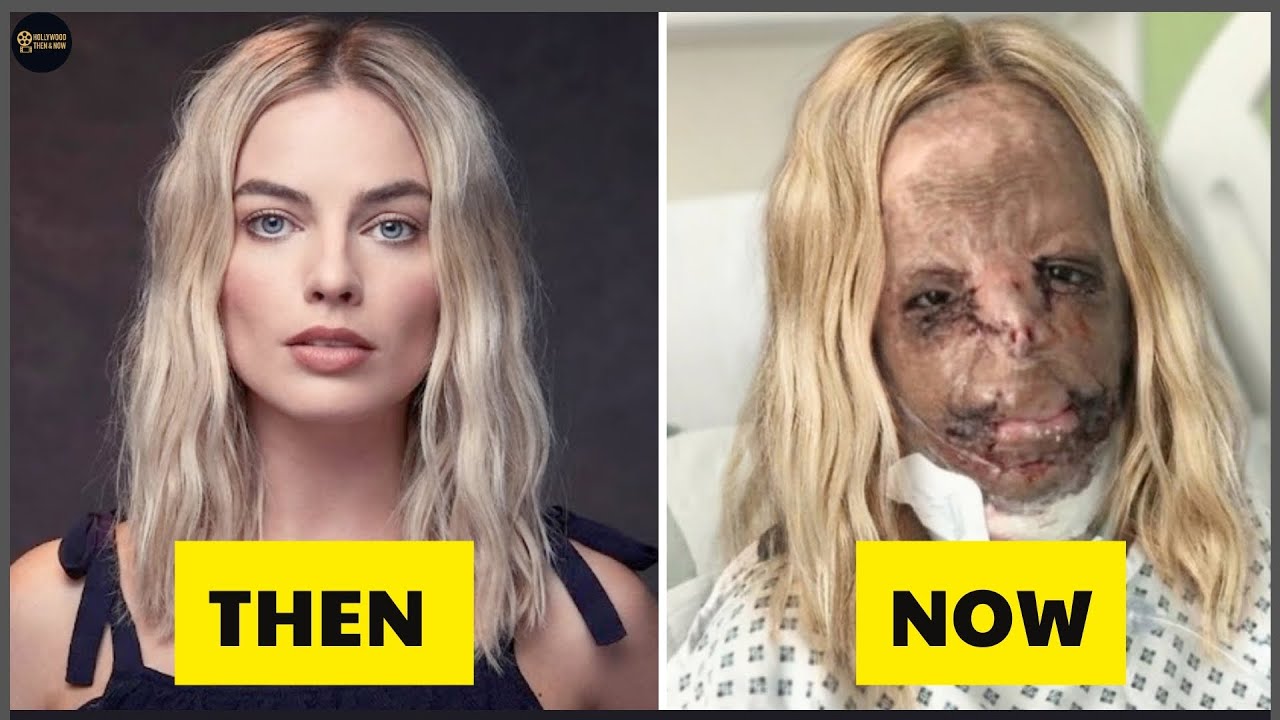15 Celebrity Plastic Surgery Disasters That Ruined Their Looks | Then and Now 2026