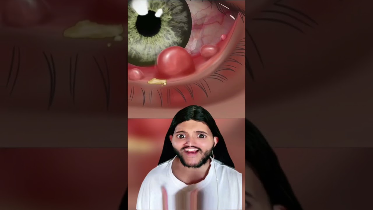 me ajuda me seguindo 🎭..