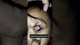 eye 👁️👁️👁️👁️ problem #likesharesubscribe #lifestyle #comedy #hostellife #love #pharmcist #duet #bev