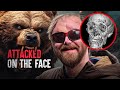 Bear Attack Survivor Tells All