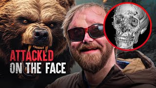 How I Survived Being Mauled by a Bear