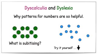 Dyscalculia | Dyslexia Maths Video | Why do we use number patterns? | Number Sense