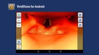 Overview of the VividVision application for Android screenshot 3