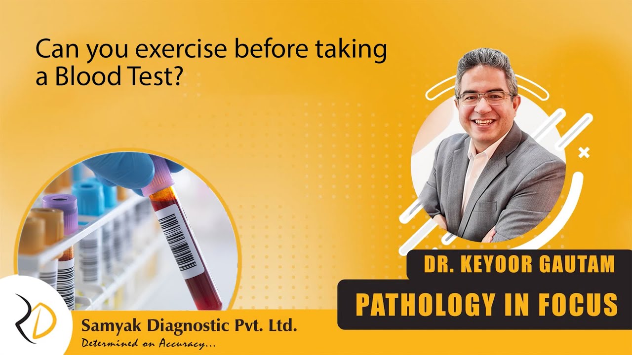 Episode 85 Can You Exercise Before Taking A Blood Test YouTube