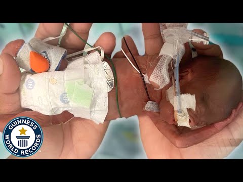 Most Premature Baby - Guinness World Records