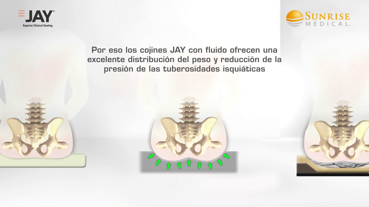 Los cojines antiescaras JAY