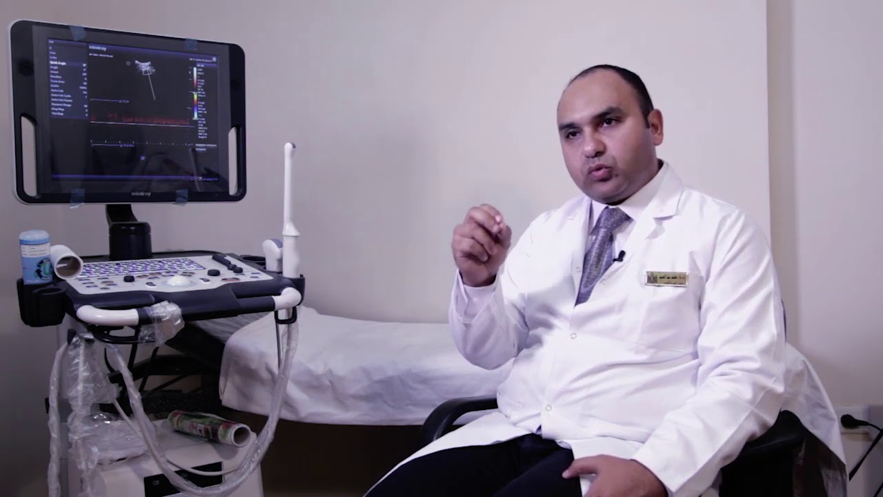 متابعة التبويض والسونار المهبلى