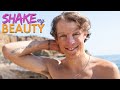 75% Of My Body Is Burnt | SHAKE MY BEAUTY