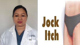 What causes jock itch/Ringworm in Men😱😱? Prevention &treatment of jock itch??
