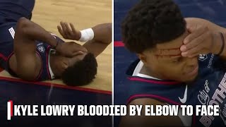 Kyle Lowry exits to locker room after elbow to the face in 76ers debut | NBA on ESPN