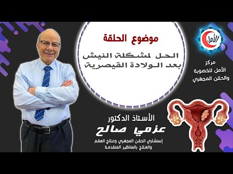 الحل لمشكلة النيش  بعد الولادة القيصرية مركز الأمل للخصوبة دكتور عزمي صالح
