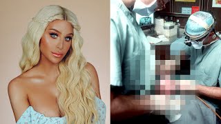 Where I’Ve Been… My Horrific Surgery