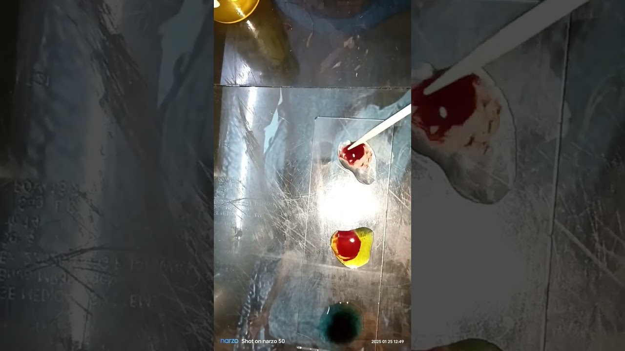 Blood grouping test step by step in this video....🩸 A (positive) blood group....... 