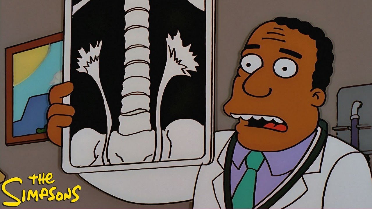 The Simpsons S10E08 Homer Simpson in: 'Kidney Trouble'