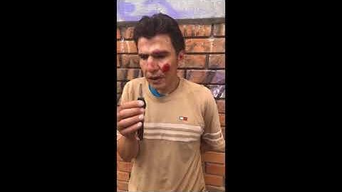 RATERO INTERROGADO DESPUÉS DE QUE LA VICTIMA LO GOLPEO Y LA POLICÍA LO SALVO