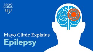 What is epilepsy? A Mayo Clinic expert explains