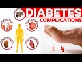 Do you know diabetes causes Renal and heart Failure? #diabetes