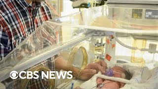 New study uncovers differences in care for extremely preterm infants