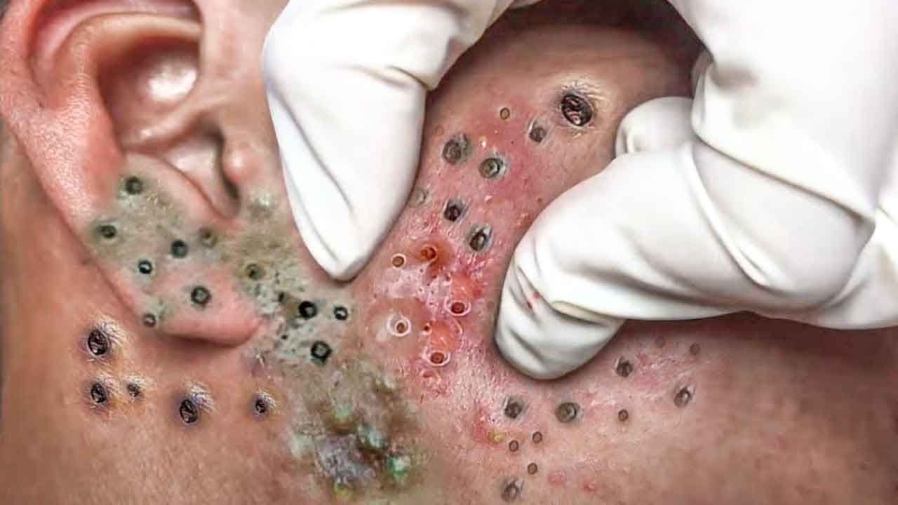 𝑺𝒐𝒐𝒕𝒉𝒊𝒏𝒈 𝑭𝒂𝒄𝒊𝒂𝒍 𝑻𝒓𝒆𝒂𝒕𝒎𝒆𝒏𝒕 𝒇𝒐𝒓 𝑺𝒕𝒓𝒆𝒔𝒔 𝑹𝒆𝒍𝒊𝒆𝒇 | 𝑫𝒆𝒆𝒑 𝑪𝒍𝒆𝒂𝒏𝒊𝒏𝒈 & 𝑪𝒂𝒍𝒎𝒊𝒏𝒈 𝑴𝒂𝒔𝒔𝒂𝒈𝒆 𝒂𝒕 𝑳𝒖𝒙𝒖𝒓𝒚 𝑺𝒑𝒂 #4898