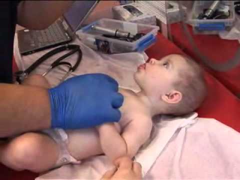 Video: Vaccine succes: Rotavirus Jab For Babyer hjælper med at skære sager