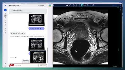 Experimenting with Google Gemini and Imaging Data Commons