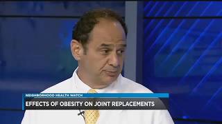 Obesity and Surgery - Dr. Schroeder - Neighborhood Health Watch