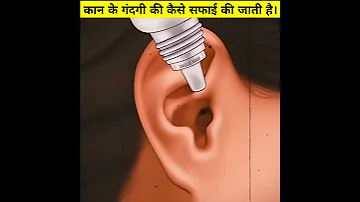 How Ear Wax Is Removed 3D Animation Shorts 