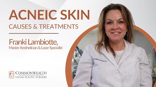 Acneic Skin Causes Treatments