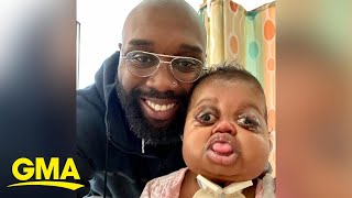 Dad pens letters to his baby with Pfeiffer syndrome, vows to be father he never had l GMA