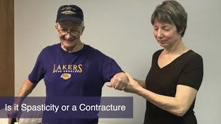 is it spasticity or a contracture