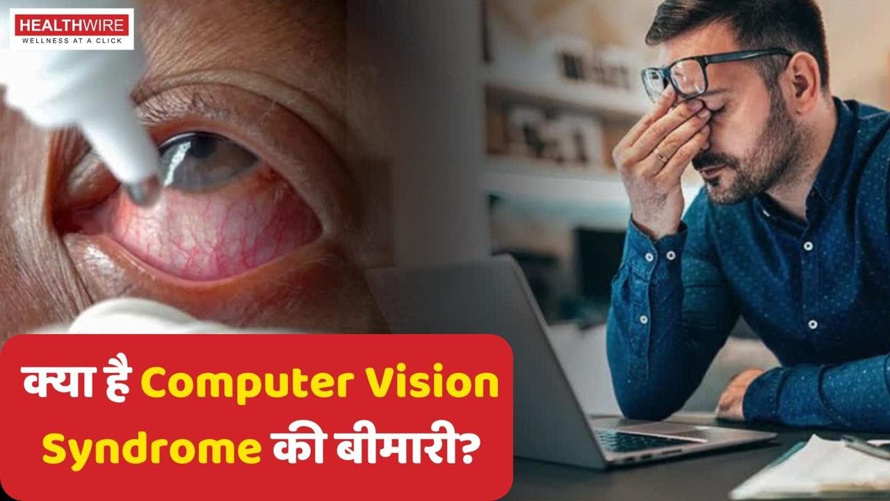 Computer Vision Syndrome कैसे Youth को बना रहा है अँधा? | Dr. Rahul ...
