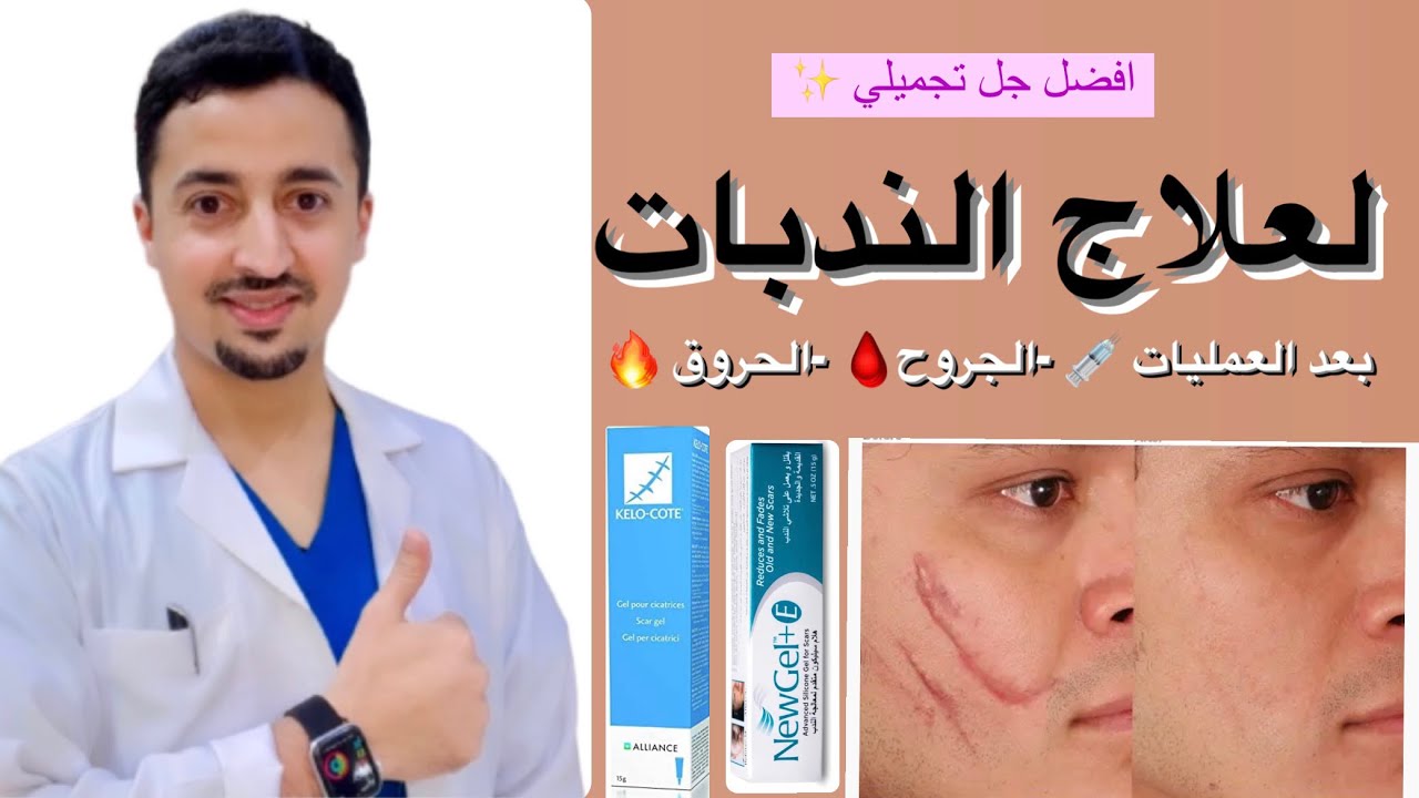 🥇جل سيليكون لعلاج الندبات  -اثار حب الشباب-بعد العمليات والحروق