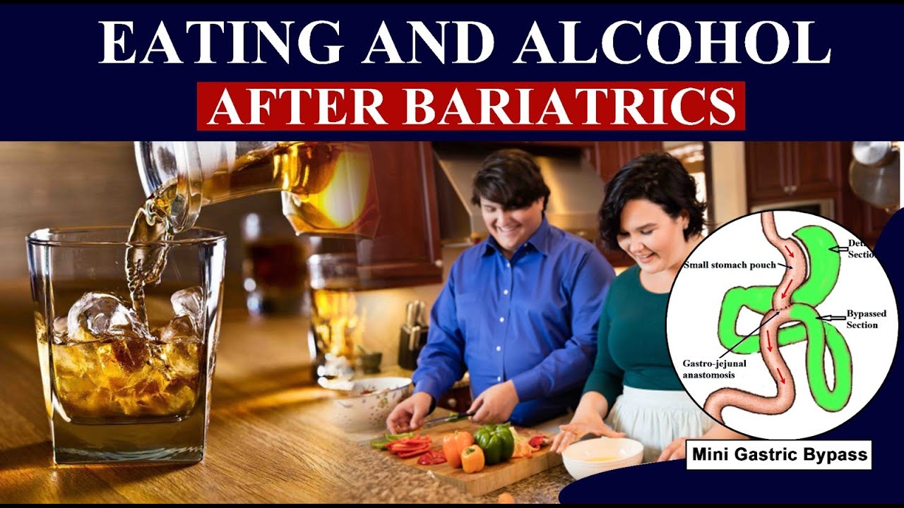 Alcohol & eating after Bariatric Surgery. How to handle ? Best MGB