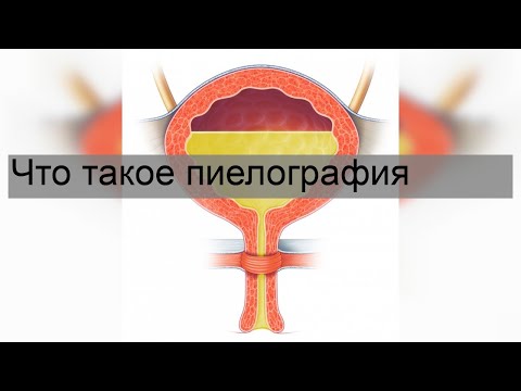 Что такое пиелография