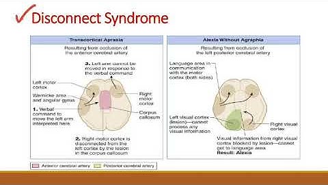 Disconnect Syndromes - Transcortical Apraxia & Alexia without Agraphia
