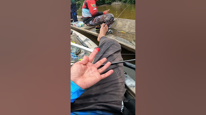 Piranha bites my finger