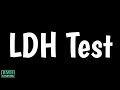 Blood ldh test  lactate dehydrogenase test  ld test 