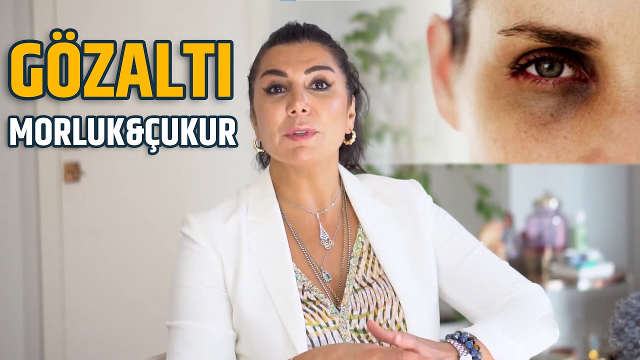 Goz Alti Cokmesi Ve Cukurlari Tedavisi Fiyatlari 2021 Op Dr Leyla Arvas