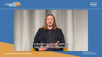 Weighted gene co-expression network analysis in asymptomatic Alzheimer