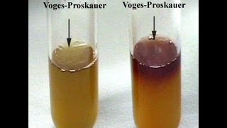 Voges-Proskauer Test - Amrita University